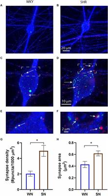 Heightened sympathetic neuron activity and altered cardiomyocyte properties in spontaneously hypertensive rats during the postnatal period